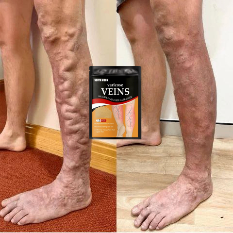 Parche Para Varices
